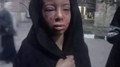 واقعة صادمة تهدد أمن المجتمع.. طفلة قاصر ضحية اعتداء خطير بالشرقية