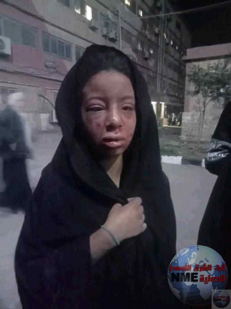 واقعة صادمة تهدد أمن المجتمع.. طفلة قاصر ضحية اعتداء خطير بالشرقية